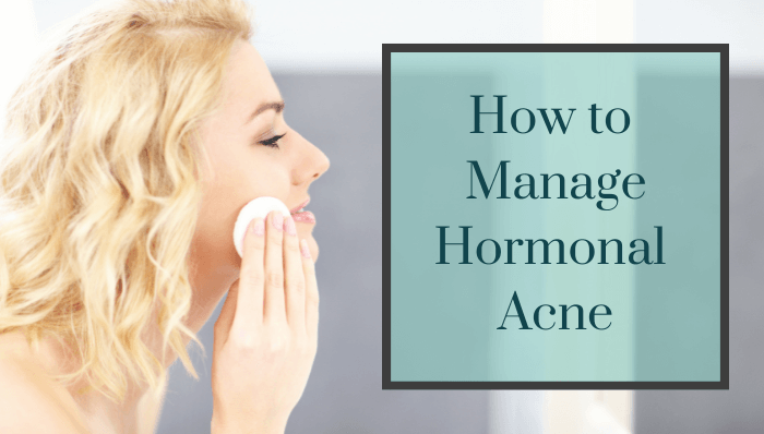 How to Manage Hormonal Acne