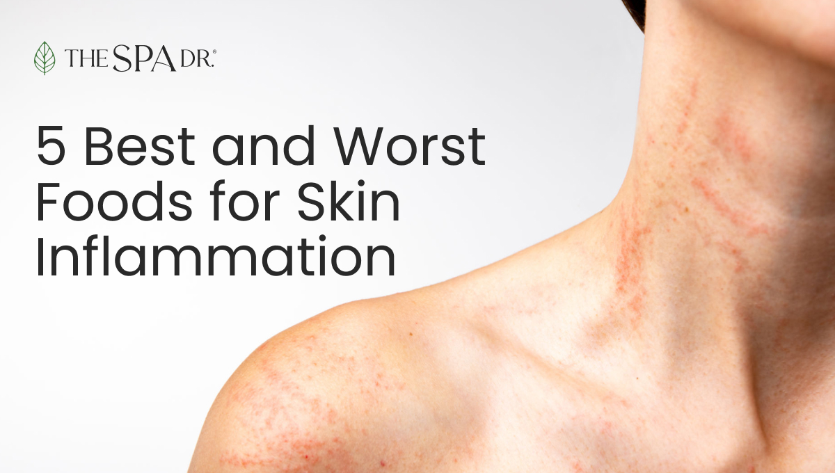 Foods that cause skin inflammation