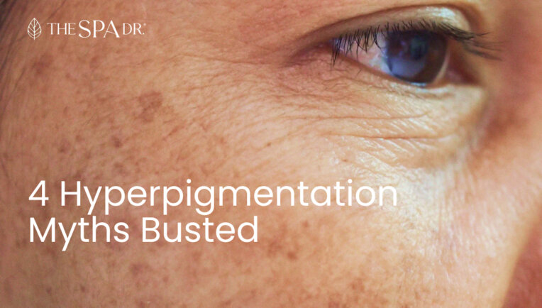 Hyperpigmentation Myths