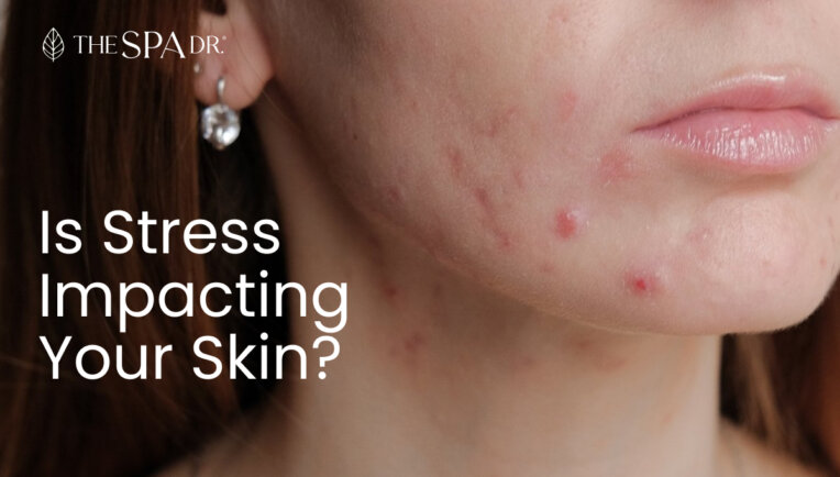 Hormones and Stress impacting skin