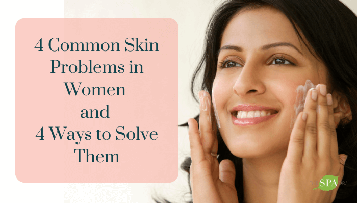 4 Common Skin Problems in Women and 4 Ways to Solve Them