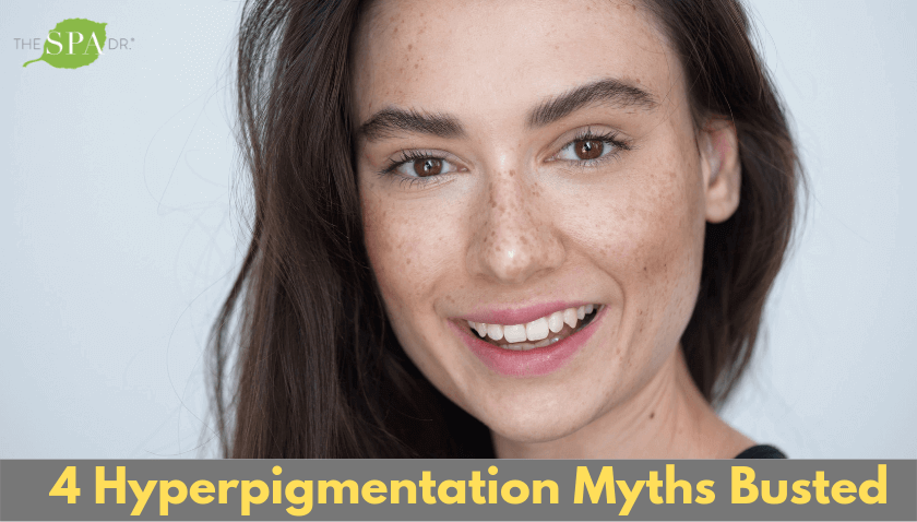 4 Hyperpigmentation Myths Busted