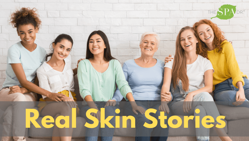 Real Skin Stories