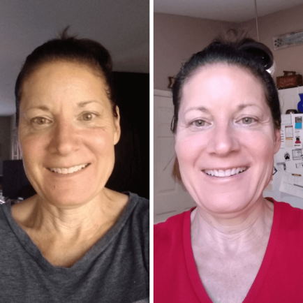 Before and After using The Spa Dr. Products