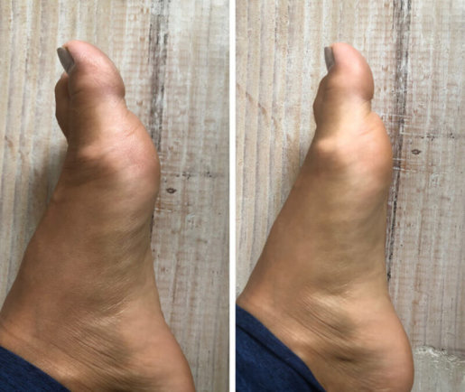 The Spa Dr. Beauty Bundle Before and After feet images