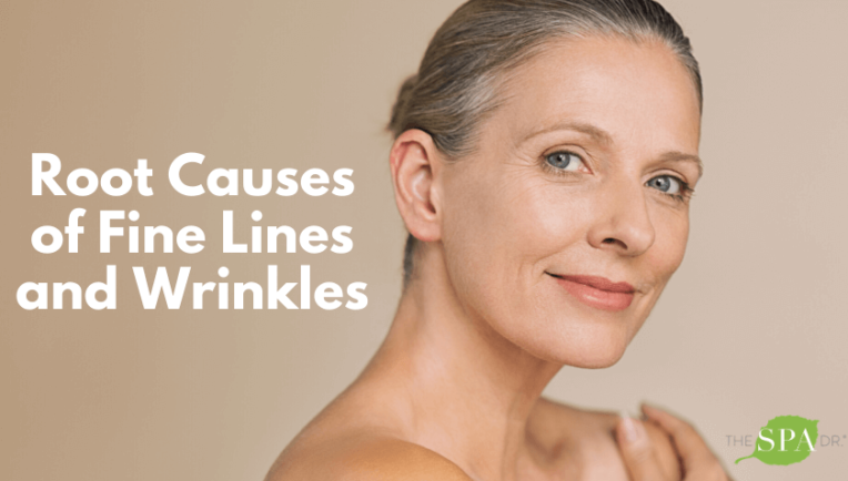 Common causes and symptoms of fine lines & wrinkles?